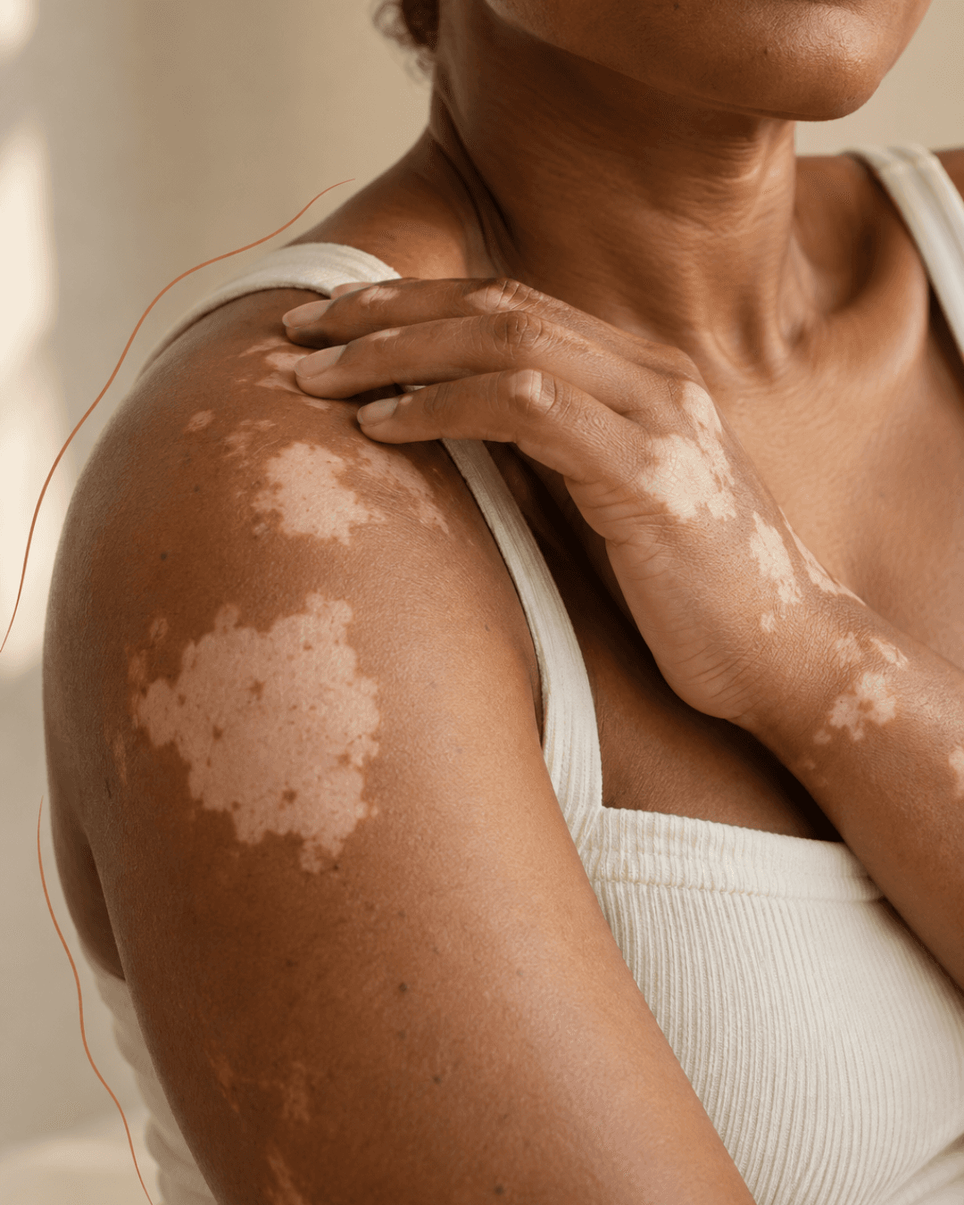 Close-up of a person’s shoulders and hands showing natural variation in skin
